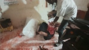 Malam Berdarah di Seunuddon, Ibu dan Anak Diserang Pria Bersenjata Tajam di Dalam Rumah