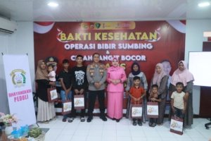 Kapolres Lhokseumawe Resmi Buka Operasi Bibir Sumbing Gratis, 20 Pasien Dapat Harapan Baru di HUT Bhayangkara ke-80